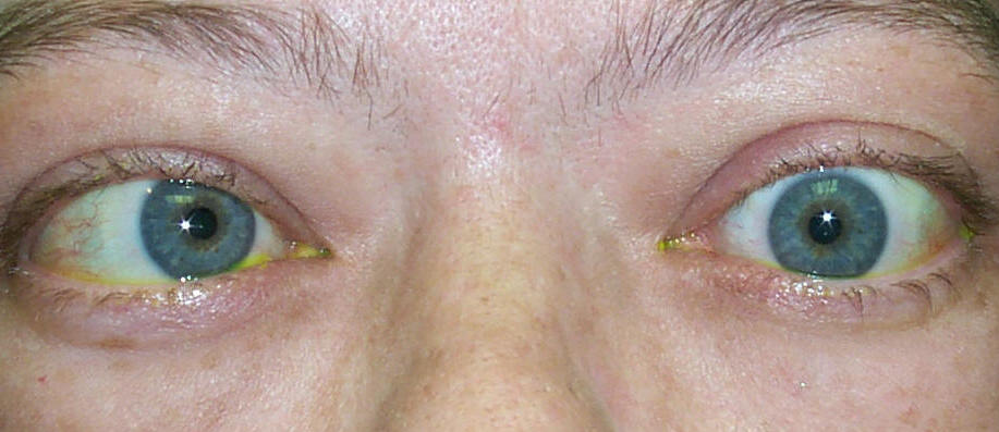 Cosmetic and Reconstructive Surgery of the eyelids, orbits and tear ducts